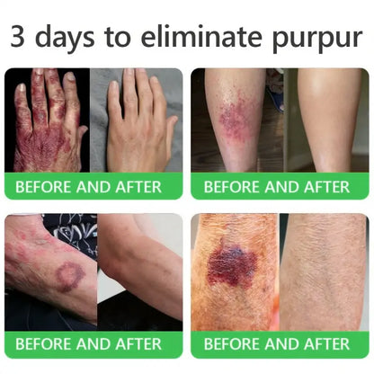 𝐎𝐫𝐢𝐚𝐜𝐡® 𝐀𝟏𝟎+ 𝟔-𝐢𝐧-𝟏 𝐃𝐞𝐫𝐦𝐚𝐑𝐞𝐩𝐚𝐢𝐫 𝐒𝐞𝐫𝐮𝐦 🇮🇪 𝐇𝐒𝐄 & 𝐄𝐔-𝐆𝐌𝐏 𝐂𝐞𝐫𝐭𝐢𝐟𝐢𝐞𝐝 – 𝐅𝐢𝐫𝐦𝐬 𝐥𝐨𝐨𝐬𝐞 𝐬𝐤𝐢𝐧, 𝐫𝐞𝐝𝐮𝐜𝐞𝐬 𝐛𝐫𝐮𝐢𝐬𝐢𝐧𝐠 𝐚𝐧𝐝 𝐚𝐠𝐞-𝐫𝐞𝐥𝐚𝐭𝐞𝐝 𝐬𝐤𝐢𝐧 𝐝𝐢𝐬𝐜𝐨𝐥𝐨𝐮𝐫𝐚𝐭𝐢𝐨𝐧, 𝐚𝐧𝐝 𝐭𝐫𝐞𝐚𝐭𝐬 𝐤𝐞𝐫𝐚𝐭𝐢𝐧 𝐛𝐮𝐢𝐥𝐝𝐮𝐩, 𝐬𝐞𝐛𝐨𝐫𝐫𝐡𝐨𝐞𝐢𝐜 𝐝𝐞𝐫𝐦𝐚𝐭𝐢𝐭𝐢𝐬, 𝐚𝐧𝐝 𝐟𝐨𝐥𝐥𝐢𝐜𝐮𝐥𝐚𝐫 𝐤𝐞𝐫𝐚𝐭𝐨𝐬𝐢𝐬.