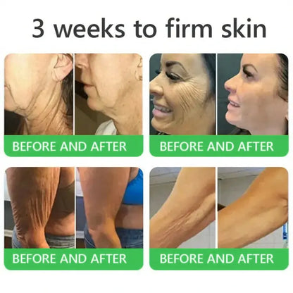 𝐎𝐫𝐢𝐚𝐜𝐡® 𝐀𝟏𝟎+ 𝟔-𝐢𝐧-𝟏 𝐃𝐞𝐫𝐦𝐚𝐑𝐞𝐩𝐚𝐢𝐫 𝐒𝐞𝐫𝐮𝐦 🇮🇪 𝐇𝐒𝐄 & 𝐄𝐔-𝐆𝐌𝐏 𝐂𝐞𝐫𝐭𝐢𝐟𝐢𝐞𝐝 – 𝐅𝐢𝐫𝐦𝐬 𝐥𝐨𝐨𝐬𝐞 𝐬𝐤𝐢𝐧, 𝐫𝐞𝐝𝐮𝐜𝐞𝐬 𝐛𝐫𝐮𝐢𝐬𝐢𝐧𝐠 𝐚𝐧𝐝 𝐚𝐠𝐞-𝐫𝐞𝐥𝐚𝐭𝐞𝐝 𝐬𝐤𝐢𝐧 𝐝𝐢𝐬𝐜𝐨𝐥𝐨𝐮𝐫𝐚𝐭𝐢𝐨𝐧, 𝐚𝐧𝐝 𝐭𝐫𝐞𝐚𝐭𝐬 𝐤𝐞𝐫𝐚𝐭𝐢𝐧 𝐛𝐮𝐢𝐥𝐝𝐮𝐩, 𝐬𝐞𝐛𝐨𝐫𝐫𝐡𝐨𝐞𝐢𝐜 𝐝𝐞𝐫𝐦𝐚𝐭𝐢𝐭𝐢𝐬, 𝐚𝐧𝐝 𝐟𝐨𝐥𝐥𝐢𝐜𝐮𝐥𝐚𝐫 𝐤𝐞𝐫𝐚𝐭𝐨𝐬𝐢𝐬.